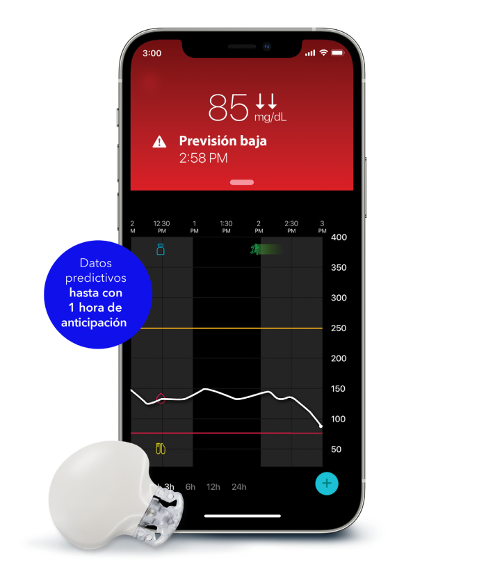 Razones para utilizar el G4​